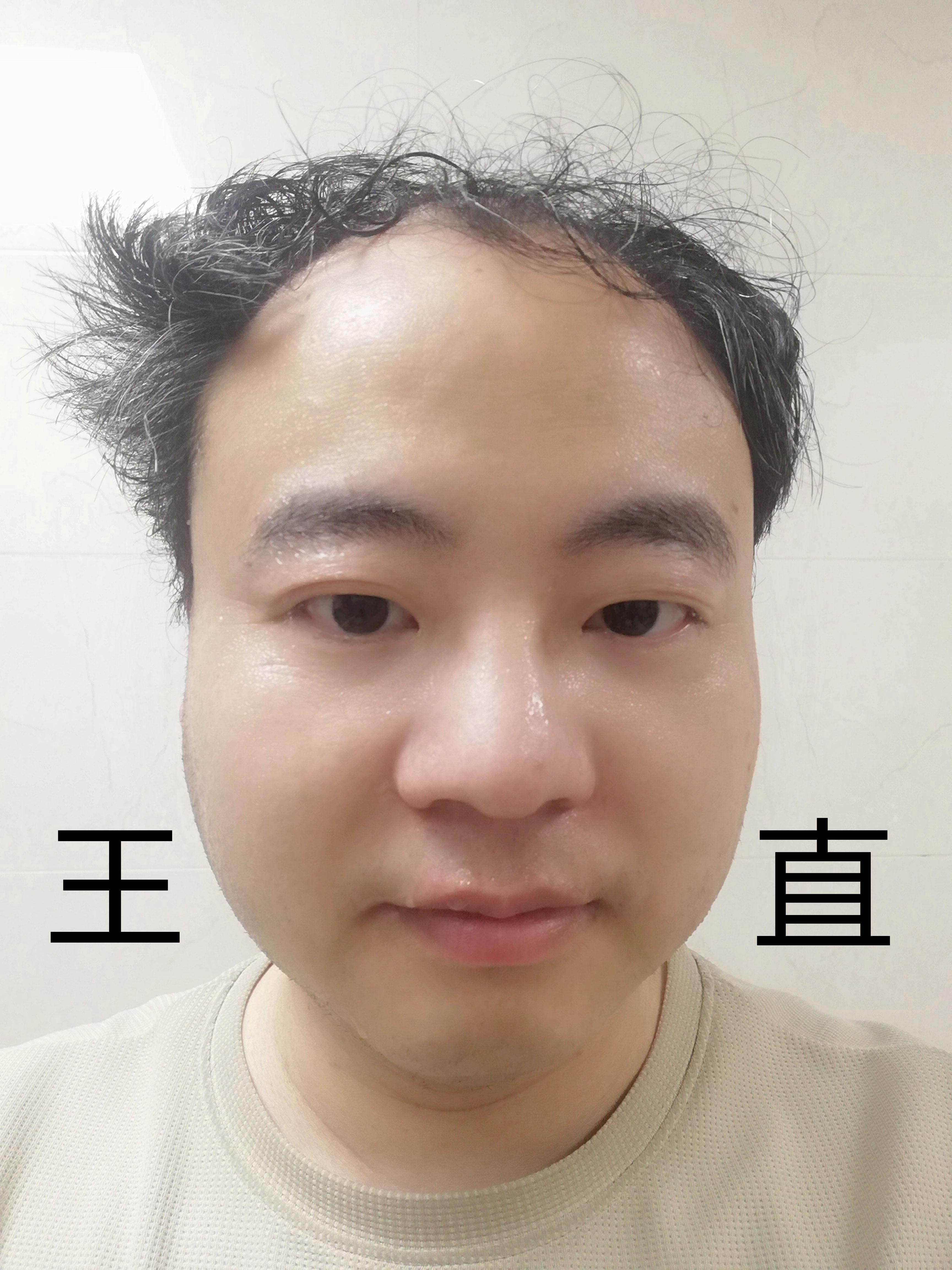 王直海贼王